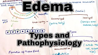 Swelling and Oedema Capillary Exchange [upl. by Dranyl]