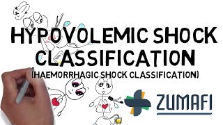 Hypovolemic Shock  Classification [upl. by Mareld]