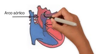 Persistencia del conducto arterioso [upl. by Adnirod]