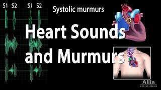 Heart Sounds and Heart Murmurs Animation [upl. by Essyla]