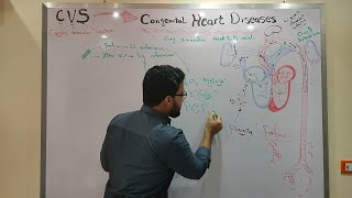 3D Echocardiography Acquisition Cropping and Case Examples [upl. by Aksoyn121]