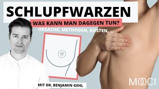 Was tun gegen SCHLUPFWARZEN Ursache OP Kosten [upl. by Spiegel150]