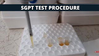 SGPT Test Procedure  SGPT Simple Test Procedure [upl. by Abdu209]