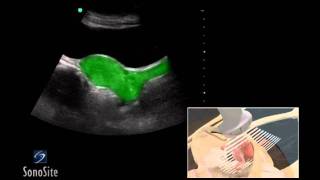 How To Female Pelvis Ultrasound Exam 3D Video [upl. by Maxwell]