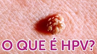 Tudo que você quer saber sobre HPV [upl. by Akemhs395]