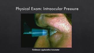 Understanding Acute Angle Closure Glaucoma [upl. by Ynnod]