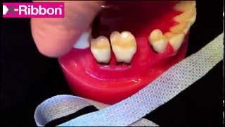 Hygienist shows how to floss PERIO teeth and IMPLANTS [upl. by Derna]