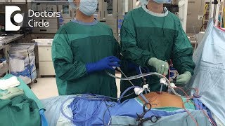 Dos amp Donts after Gynaecologic Laparoscopic Surgeries  Dr Shafalika Boriah [upl. by Llerihs]