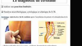 Méningites de lenfant Pr Bouchetara [upl. by Collimore]