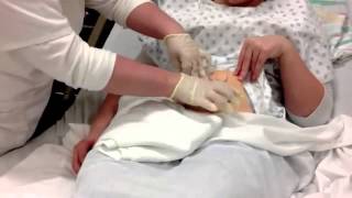 Colostomy Care Teaching Video [upl. by Adnawal616]