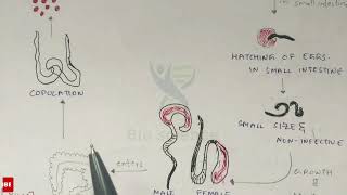 Trichuriasis  Whipworm structure Life cycle Symptoms and treatment  Bio science [upl. by Seuqcaj]