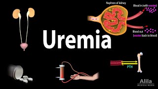 Uremia Pathophysiology Symptoms Diagnosis and Treatment Animation [upl. by Tiebout]