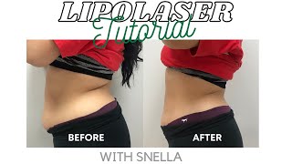 Lipolaser Tutorial  How To Use Lipolaser  Snella Body Contouring Lipolaser [upl. by Onaicram]