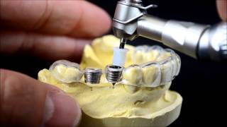 Dental implant surgical guide drilling protocol [upl. by Leffen]