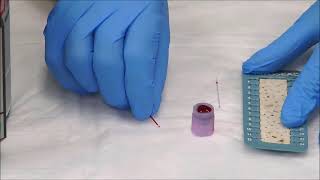 How to Measure the Hematocrit [upl. by Chil]