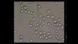 Cellule al microscopio Lievito di birra Saccharomyces Cerevisiae [upl. by Htebilil]