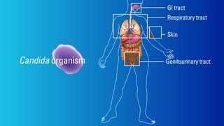 Sources of Candida Organisms [upl. by Hollister]