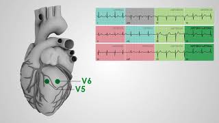 Learning to Read an ECG 8 simple steps [upl. by Bullock]