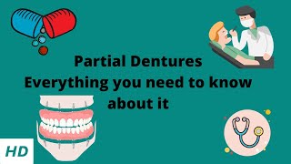 PARTIAL DENTURE Everything you need to know about them [upl. by Eillom]