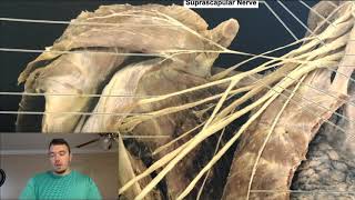 Brachial Plexus EXPLAINED Using a Cadaver [upl. by Avelin961]