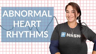 EKG like a BOSS Part 3  Abnormal Heart Rhythms [upl. by Largent]