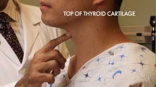 Thyroplasty Surgery by Dr Sunil Verma  UCI Health Voice amp Swallowing Center [upl. by Atinrahc]