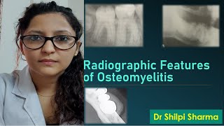 Radiographic Features of Osteomyelitis [upl. by Natam]