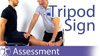 Tripod Sign  Hamstring Contractures [upl. by Eilyac574]