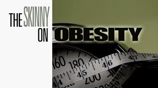 The Complete Skinny on Obesity [upl. by Anica189]