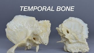 TEMPORAL BONE [upl. by Renner]