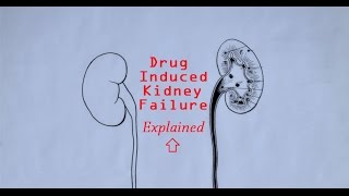 Drug Induced Renal Failure  Causes Symptoms amp Stages Doctor Interview [upl. by Dyanna]