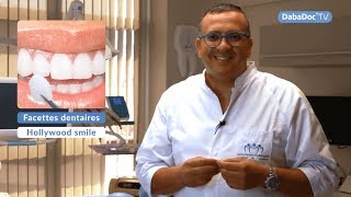 Dr Mohamed Tajmouati  Hollywood Smile  Facettes dentaires [upl. by Llewsor]