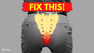 How to Fix Tailbone Pain for Good [upl. by Zzahc]