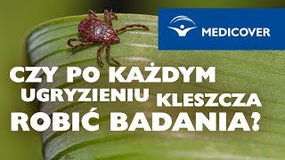 Czy po każdym ugryzieniu kleszcza trzeba robić badania [upl. by Nalon34]