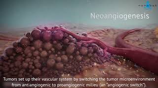 SKIN CANCER Non Melanocytic Part 1 Anatomy Etiopathogenesis amp Classification [upl. by Romona494]