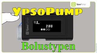 YpsoPump Verschiedene Bolustypen Insulinpumpe mylife Diabetescare 07 [upl. by Anomahs577]