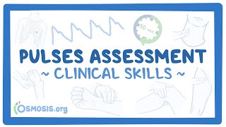 Clinical Skills Pulses assessment [upl. by Aznarepse293]