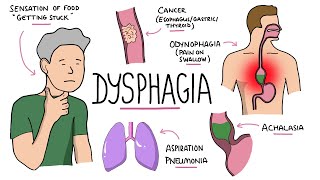 Improving the Dysphagia Diet [upl. by Podvin]