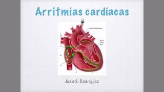 Arritmias cardíacas en el EKG [upl. by Nylorac416]