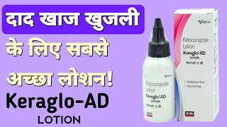 Keraglo AD Lotion How To Use For Skin In Hindi  Fungal Infection Treatment Through Ketoconazole [upl. by Ailen]