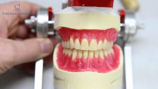 How Dentures Are Made [upl. by Kovacs]