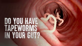 How to Survive Tapeworms Warning distressing footage [upl. by Nissie]