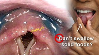 Introduction to Larynx Pharynx and Airway Anatomy [upl. by Irat]