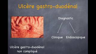 Ulcère gastrique et duodénal Gastrite [upl. by Merriam]