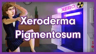 Xeroderma Pigmentosum Mnemonic for USMLE [upl. by Etiragram]