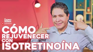 COMO REJUVENECER TU PIEL CON ISOTRETINOINA [upl. by Adnat]