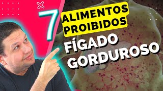 FÍGADO GORDUROSO 7 ALIMENTOS PROIBIDOS PARA GORDURA NO FÍGADO SINTOMAS DA ESTEATOSE HEPÁTICA [upl. by Hnaht155]