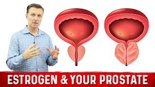 How To Fix Enlarged Prostate Explained By Dr Berg [upl. by Lathan]