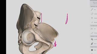 Hip Bone  Anatomy  Easy [upl. by Addis112]