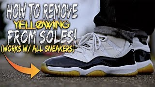 HOW TO REMOVE YELLOWING FROM SOLES WORKS W ANY SHOES [upl. by Samuela]